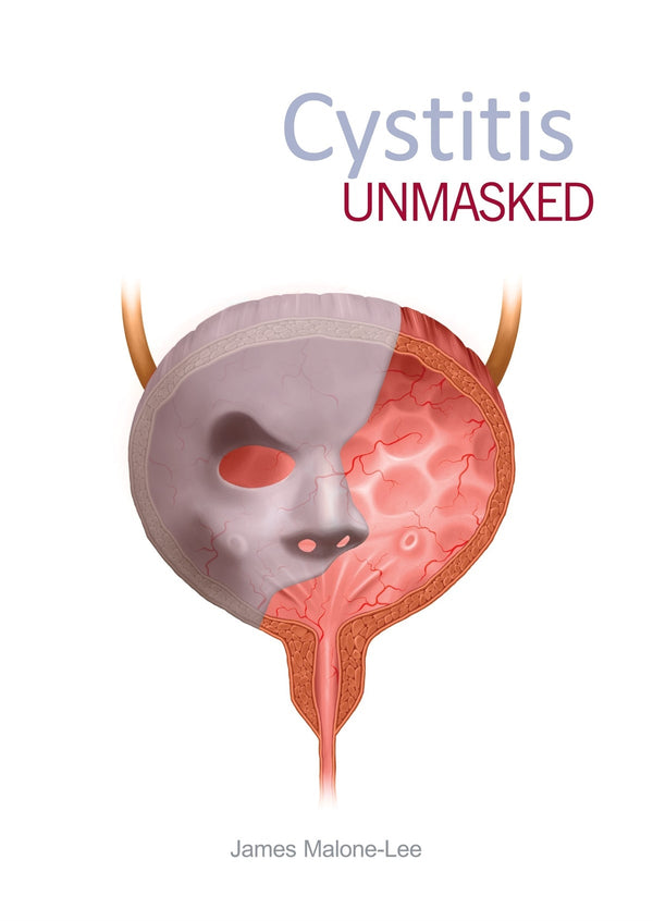 Cystitis unmasked – E-bok – Laddas ner-Digitala böcker-Axiell-peaceofhome.se