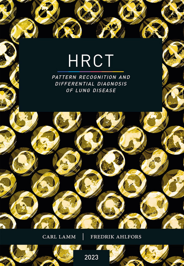 HRCT – Pattern Recognition and Differential Diagnosis of Lung Disease – E-bok – Laddas ner-Digitala böcker-Axiell-peaceofhome.se