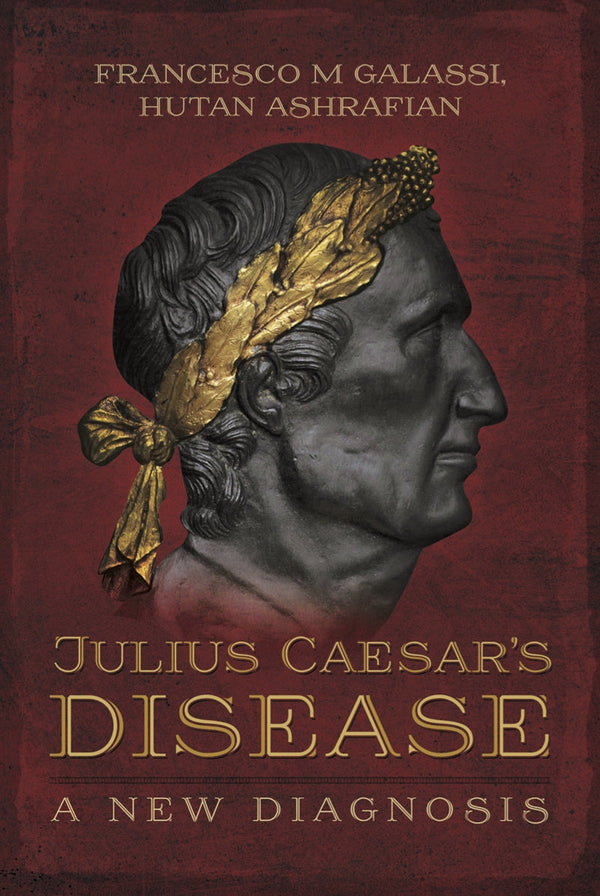 Julius Caesar's Disease – E-bok – Laddas ner-Digitala böcker-Axiell-peaceofhome.se