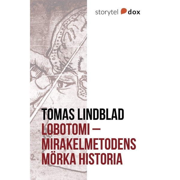 Lobotomi - Mirakelmetodens mörka historia – E-bok – Laddas ner-Digitala böcker-Axiell-peaceofhome.se