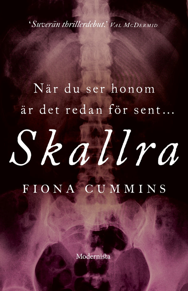 Skallra (Första boken i Samlaren-serien) – E-bok – Laddas ner-Digitala böcker-Axiell-peaceofhome.se